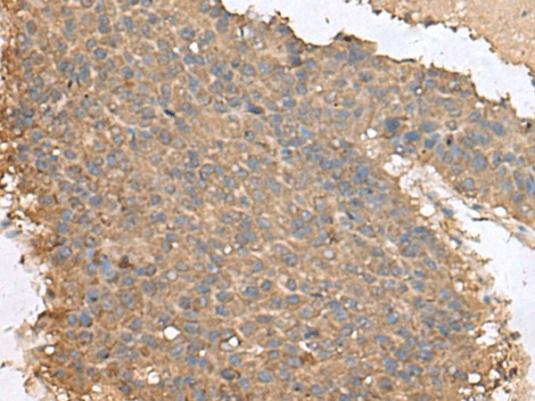 FAM19A4 Polyclonal Antibody – Figure 1 of 3