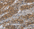 INPPL1 Polyclonal Antibody – Figure 1 of 2