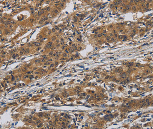 INPPL1 Polyclonal Antibody – Figure 1 of 2