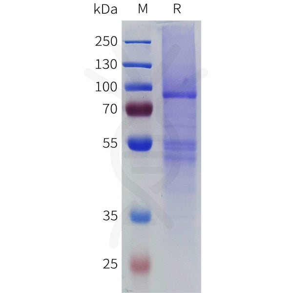 Biotinylated Mouse IL10RA full length protein-synthetic nanodisc – Figure 1 of 1