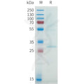 Biotinylated Human CLDN18.2 full length protein-synthetic nanodisc – Figure 1 of 1