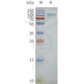 Human beta2AR-GPR75-BRIL full length protein-synthetic nanodisc – Figure 1 of 1