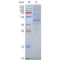 Human GPR87 full length protein-synthetic nanodisc – Figure 1 of 1