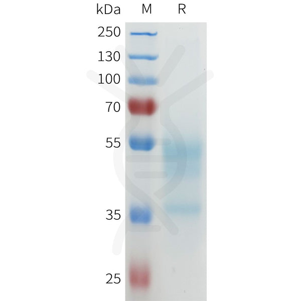 Biotinylated Human CXCR4 full length protein-synthetic nanodisc – Figure 1 of 1