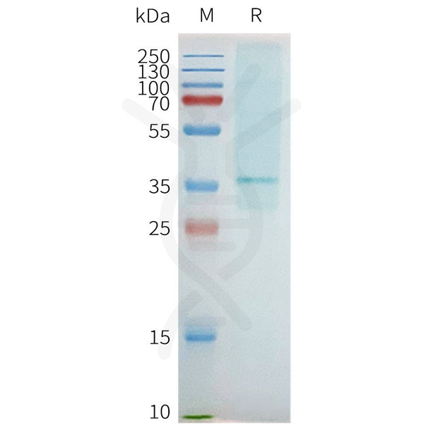 Human ADORA2B full length protein-synthetic nanodisc – Figure 1 of 1