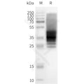 Human BDKRB2 full length protein-synthetic nanodisc – Figure 1 of 1