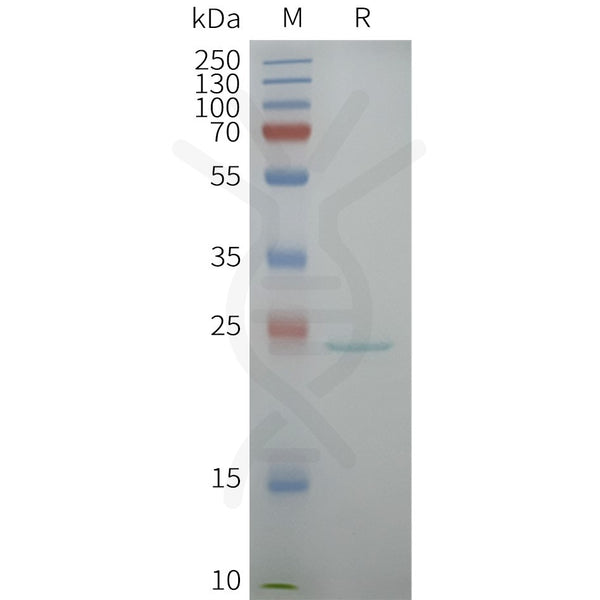 Human AQP5 full length protein-synthetic nanodisc – Figure 1 of 1