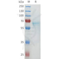 Biotinylated Human CD4 full length protein-synthetic nanodisc – Figure 1 of 1