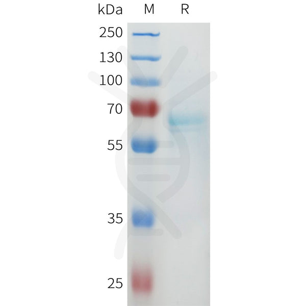 Biotinylated Human CD4 full length protein-synthetic nanodisc – Figure 1 of 1