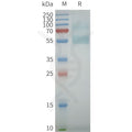 Human 5HT7R full length protein-synthetic nanodisc – Figure 1 of 1