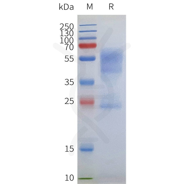 Human ACKR1 full length protein-synthetic nanodisc – Figure 1 of 1