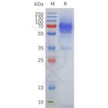 Human ADRA2A full length protein-synthetic nanodisc – Figure 1 of 1