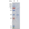 Human GPR21 full length protein-synthetic nanodisc – Figure 1 of 1