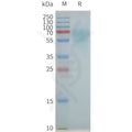 Human NK1R full length protein-synthetic nanodisc – Figure 1 of 1