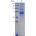 Biotinylated Human NK2R full length protein-synthetic nanodisc – Figure 1 of 1