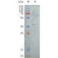 Human OXYR full length protein-synthetic nanodisc – Figure 1 of 1