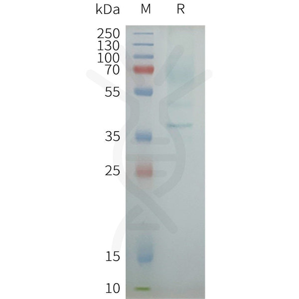 Human OXYR full length protein-synthetic nanodisc – Figure 1 of 1