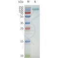 Human SLC34A2 full length protein-synthetic nanodisc – Figure 1 of 1