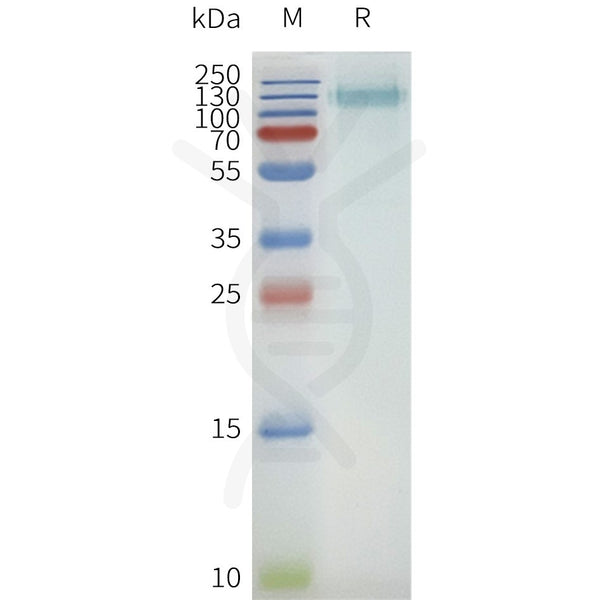 Human SLC34A2 full length protein-synthetic nanodisc – Figure 1 of 1