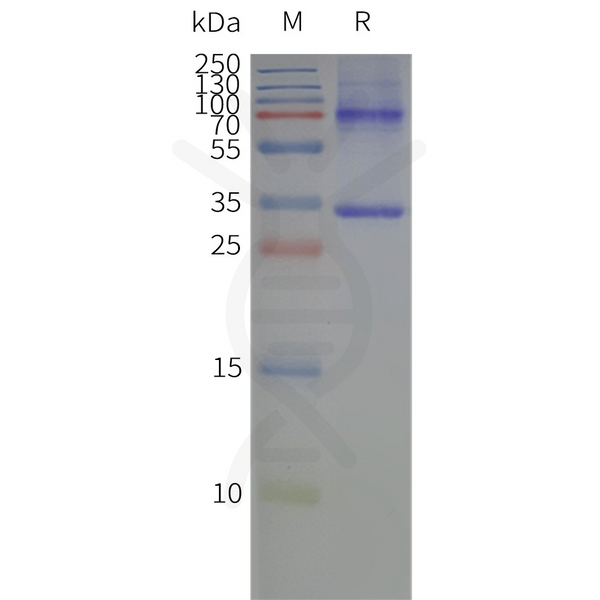 Human AQP4-M23 full length protein-synthetic nanodisc – Figure 1 of 1