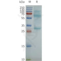 Human CACNG1 full length protein-synthetic nanodisc – Figure 1 of 1