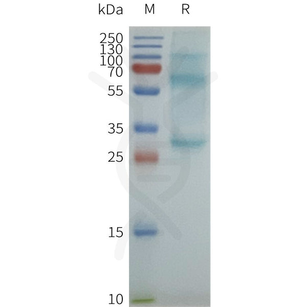 Human CACNG1 full length protein-synthetic nanodisc – Figure 1 of 1