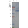 Human SSTR2-Strep full length protein-synthetic nanodisc – Figure 1 of 1