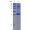 Human CLDN18.2-Strep full length protein-synthetic nanodisc – Figure 1 of 1
