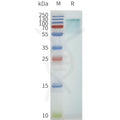 Human GPR75-Strep full length protein-synthetic nanodisc – Figure 1 of 1