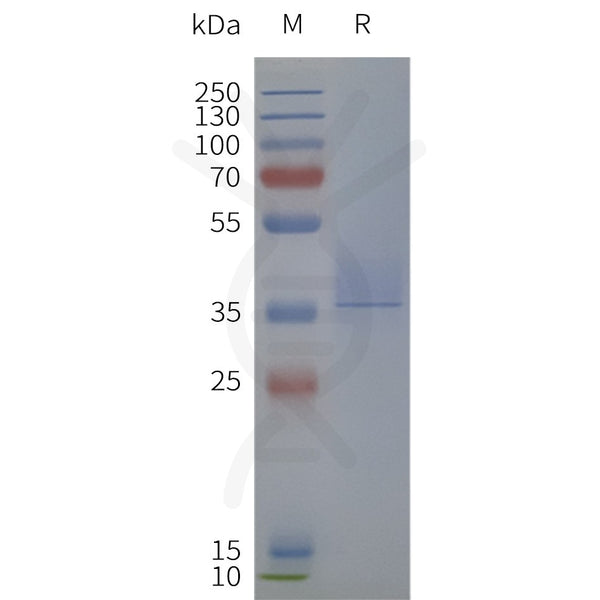 Human CCR8-Strep full length protein-synthetic nanodisc – Figure 1 of 1