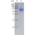 Human CXCR6-Strep full length protein-synthetic nanodisc – Figure 1 of 1