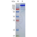 Human MBP-TRPV1-Strep full length protein-synthetic nanodisc – Figure 1 of 1