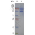 Human 5HT1A-Strep full length protein-synthetic nanodisc – Figure 1 of 1