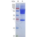 Human ACKR1-Strep full length protein-synthetic nanodisc – Figure 1 of 1