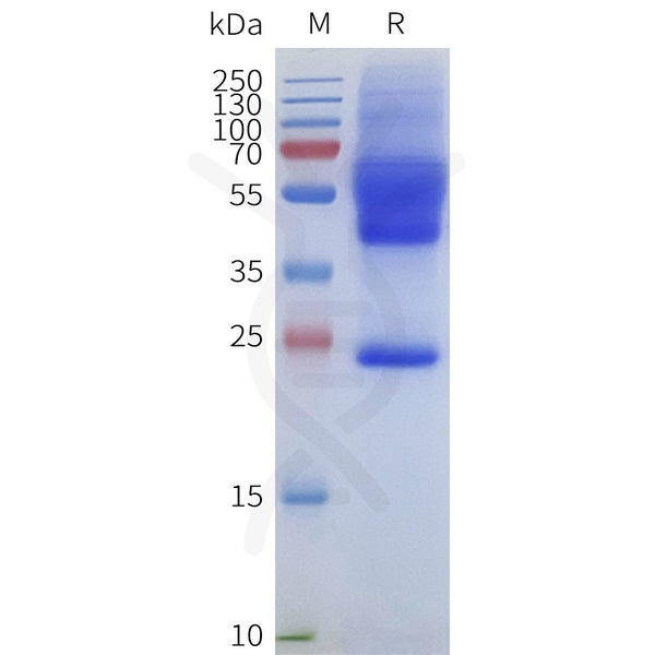 Human ACKR1-Strep full length protein-synthetic nanodisc – Figure 1 of 1