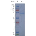 Human ADRB2-Strep full length protein-synthetic nanodisc – Figure 1 of 1