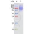 Human ADRB3-Strep full length protein-synthetic nanodisc – Figure 1 of 1