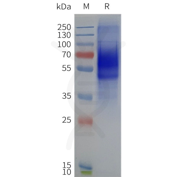 Human CRHR1-Strep full length protein-synthetic nanodisc – Figure 1 of 1
