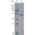 Human DRD4-Strep full length protein-synthetic nanodisc – Figure 1 of 1