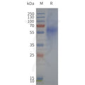 Human FPR1-Strep full length protein-synthetic nanodisc – Figure 1 of 1