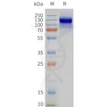Human GABR2-Strep full length protein-synthetic nanodisc – Figure 1 of 1