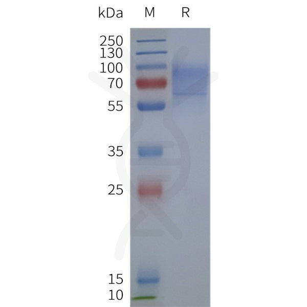 Human GPR161-Strep full length protein-synthetic nanodisc – Figure 1 of 1