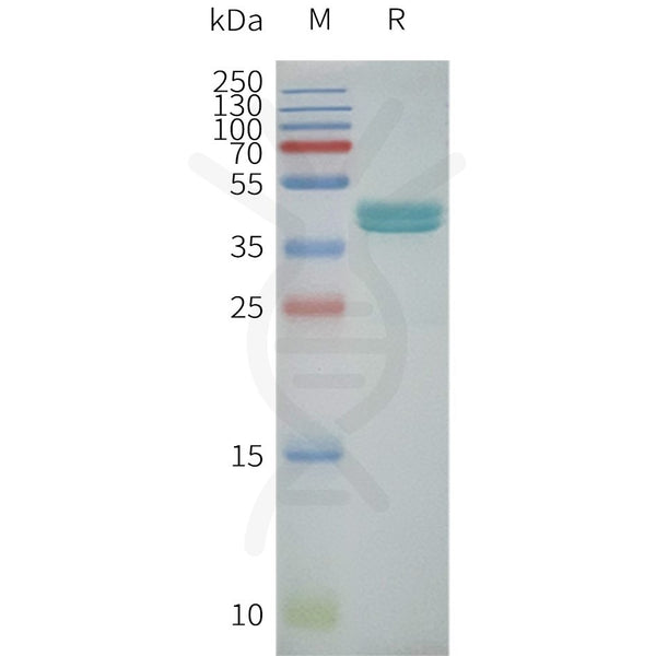 Human GPRC5C-Strep full length protein-synthetic nanodisc – Figure 1 of 1
