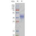 Human GPR15-Strep full length protein-synthetic nanodisc – Figure 1 of 1