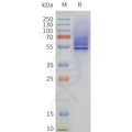 Human HRH1-Strep full length protein-synthetic nanodisc – Figure 1 of 1