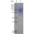 Human LPAR1-Strep full length protein-synthetic nanodisc – Figure 1 of 1