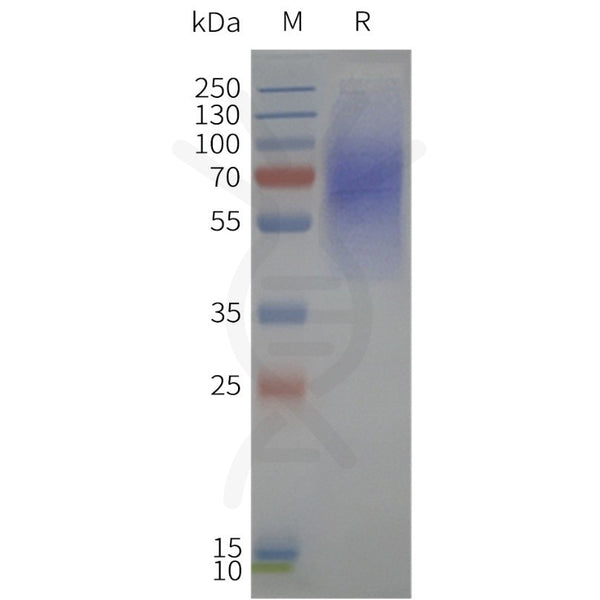Human LPAR1-Strep full length protein-synthetic nanodisc – Figure 1 of 1