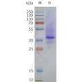 Human LPAR2-Strep full length protein-synthetic nanodisc – Figure 1 of 1