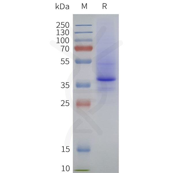 Human LPAR2-Strep full length protein-synthetic nanodisc – Figure 1 of 1