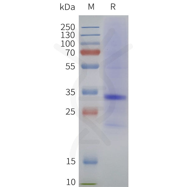 Human MC1R-Strep full length protein-synthetic nanodisc – Figure 1 of 1